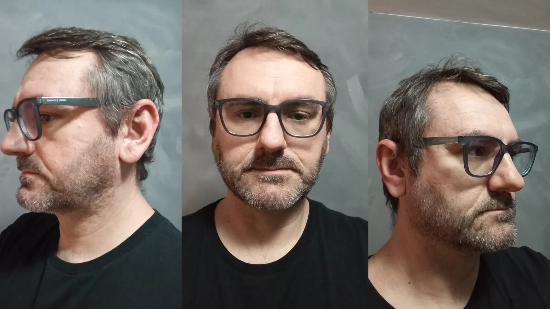 Fotos de referência do rosto do modelo em três ângulos, feitas com celular.